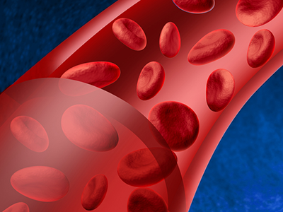Blood disease, Symptoms, Treatments